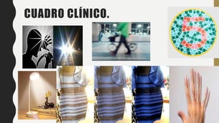 CUADRO CLÍNICO.
 