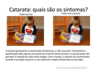 Catarata: quais são os sintomas? Fonte: www.bancodesaude.com.br Visão normal Visão com catarata A catarata geralmente se desenvolve lentamente, e não causa dor. Inicialmente a opacificação afeta apenas uma parte do cristalino (lente ocular), e a pessoa pode não perceber a redução da visão neste estágio. Com o tempo, a catarata vai aumentando, levando à turvação visual ou a uma visão com imagens distorcidas ou borradas. 