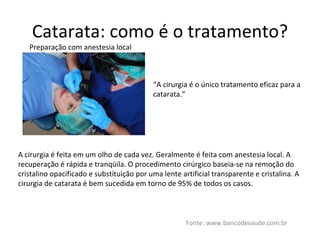 Catarata: como é o tratamento? Fonte: www.bancodesaude.com.br Preparação com anestesia local A cirurgia é feita em um olho de cada vez. Geralmente é feita com anestesia local. A recuperação é rápida e tranqüila. O procedimento cirúrgico baseia-se na remoção do cristalino opacificado e substituição por uma lente artificial transparente e cristalina. A cirurgia de catarata é bem sucedida em torno de 95% de todos os casos.  “ A cirurgia é o único tratamento eficaz para a catarata.” 