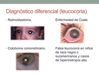 Diagnóstico diferencial (leucocoria)
• Retinoblastoma. Enfermedad de Coats
• Coloboma coriorretiniano. Falsa leucocoria en niños
de raza negra o
suramericanos y casos
de hipermetropía alta.
 