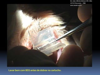 Dioptrix PFI 14 SEDr. João Alfredo Kleiner MV, MScACVO Wisconsin – 1998www.vetweb.com.brPara sacos capsulares grandes (Médio a grande porte)Incisão de 2,85 a 3,2 mmPeça única26% acrílico hidrofílicoFiltro UVDiâmetro total: 14 mmDiâmetro óptico: 6 mmBordas anguladasAngulação de alça de 100+41 D de poder refrativoEsterilizado em autoclave.