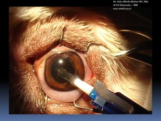 Acri-Lens VetHDr. João Alfredo Kleiner MV, MScACVO Wisconsin – 1998www.vetweb.com.brPara sacos capsulares pequenos e grandes Incisão de 3,2 mmPeça única26% acrílico hidrofílicoFiltro UVSuperfície heparinizadaDiâmetro total: 13 mmDiâmetro óptico: 6,5 mmBordas anguladas4 alças Angulação de alça de 50+41 D de poder refrativoÍndice refração: 1,46Esterilizado em autoclave.