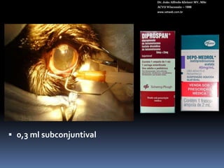 Tomografia óptica helicoidalDr. João Alfredo Kleiner MV, MScACVO Wisconsin – 1998www.vetweb.com.br