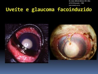 Dr. João Alfredo Kleiner MV, MScACVO Wisconsin – 1998www.vetweb.com.brVisco “ In the Bag ” para distender saco capsular.