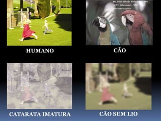 Dr. João Alfredo Kleiner MV, MScACVO Wisconsin – 1998www.vetweb.com.brCÃOHUMANOCÃO SEM LIOCATARATA IMATURA