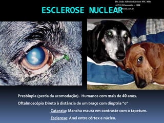 ESCLEROSENUCLEARDr. João Alfredo Kleiner MV, MScACVO Wisconsin – 1998www.vetweb.com.brPresbiopia (perda da acomodação).  Humanos com mais de 40 anos.Oftalmoscópio Direto à distância de um braço com dioptria “0”Catarata: Mancha escura em contraste com o tapetum.Esclerose: Anel entre córtex e núcleo.  