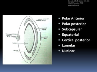 Íris escura (inflamações).Dr. João Alfredo Kleiner MV, MScACVO Wisconsin – 1998www.vetweb.com.br
