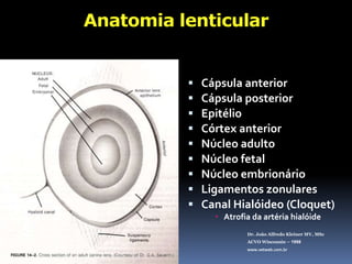 Anatomia lenticularCápsula anteriorCápsula posteriorEpitélioCórtex anteriorNúcleo adultoNúcleo fetalNúcleo embrionárioLigamentoszonularesCanal Hialóideo (Cloquet)Atrofia da artéria hialóideDr. João Alfredo Kleiner MV, MScACVO Wisconsin – 1998www.vetweb.com.br