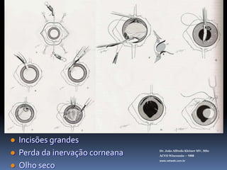 TÉCNICAS CIRÚRGICASDiscissãoExtracapsularIntracapsularFacoemulsificaçãoDr. João Alfredo Kleiner MV, MScACVO Wisconsin – 1998www.vetweb.com.br