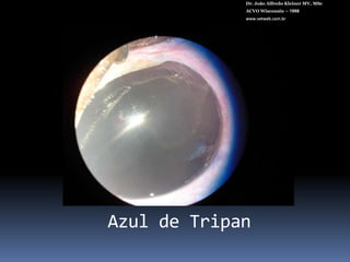 PRÉ-OPERATÓRIODr. João Alfredo Kleiner MV, MScACVO Wisconsin – 1998www.vetweb.com.brCilodex e genteal 10 dias antesMidríase total (4 – 6 horas antes)AINS ( ”Still” – diclofenaco)Atropina 1%Mydriacyl.Fenilefrina.Antibióticos tópicos (Gatifloxacino3 horas antes)Sistêmicos (cefalexina, enrofloxacina)Dexametasona IV (dose A.I.)Desinfecçãoocular (soro fisiol. + PVPI 5%)