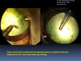 Dr. João Alfredo Kleiner MV, MScACVO Wisconsin – 1998www.vetweb.com.br