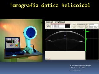 Dr. João Alfredo Kleiner MV, MScACVO Wisconsin – 1998www.vetweb.com.br1º LIO moderna em humanos implantada por	 Dr. Harold Ridley 1949.Material usado (acrílico) nos cockpits de aeronaves WW II.Iniciou na década de 80 em cãesMelhoram visão de perto e de detalhes. (EMETROPIA)