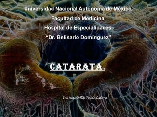 Universidad Nacional Autónoma de México.
          Facultad de Medicina.
       Hospital de Especialidades.
       “Dr. Belisario Domínguez”




         Catarata.


              Dra. María Orfilda Pineda Gutierrez
 
