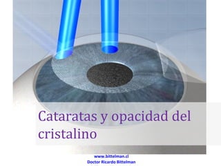Cataratas y opacidad del
cristalino
          www.bittelman.cl
       Doctor Ricardo Bittelman
 