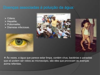 Doenças associadas á poluição da água:
 Cólera;
 Hepatite;
 Poliomielite;
 Diarreias infeciosas.
 Ás vezes, a água que parece estar limpa, contém vírus, bactérias e parasitas
que só podem ser vistos ao microscópio, são eles que provocam as doenças
acima referidas.
 