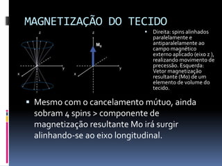 MAGNETIZAÇÃO DO TECIDO
 Mesmo com o cancelamento mútuo, ainda
sobram 4 spins > componente de
magnetização resultante M0 irá surgir
alinhando-se ao eixo longitudinal.
 Direita: spins alinhados
paralelamente e
antiparalelamente ao
campo magnético
externo aplicado (eixo z ),
realizando movimento de
precessão. Esquerda:
Vetor magnetização
resultante (M0) de um
elemento de volume do
tecido.
 