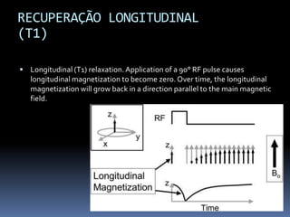 RECUPERAÇÃO LONGITUDINAL
(T1)
 Longitudinal (T1) relaxation.Application of a 90° RF pulse causes
longitudinal magnetization to become zero. Over time, the longitudinal
magnetization will grow back in a direction parallel to the main magnetic
field.
 