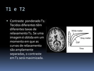T1 e T2
 Contraste ponderadoT1:
Tecidos diferentes têm
diferentes taxas de
relaxamentoT1. Se uma
imagem é obtida em um
momento em que as
curvas de relaxamento
são amplamente
separadas, o contraste
emT1 será maximizada.
 