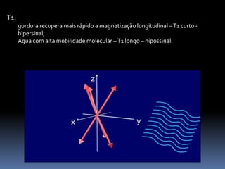 T1:
gordura recupera mais rápido a magnetização longitudinal –T1 curto -
hipersinal;
Água com alta mobilidade molecular –T1 longo – hipossinal.
 