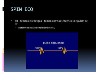  TR – tempo de repetição – tempo entre as sequências de pulsos de
RF;
 Determina o grau de relaxamento T1;
SPIN ECO
 
