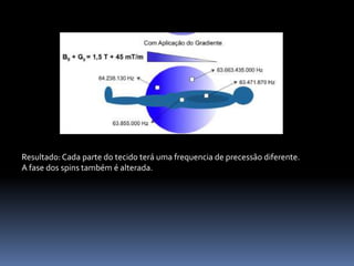 Resultado: Cada parte do tecido terá uma frequencia de precessão diferente.
A fase dos spins também é alterada.
 