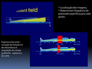 * Localização das imagens;
* Determinam frequência de
precessão específica para cada
ponto.
Espessura do corte –
variação da frequência
de ressonância e
angulação do campo
gradiente - espessura
de corte
 
