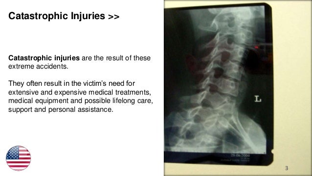 catastrophic-injuries-in-la-3-638.jpg?cb=1477680967