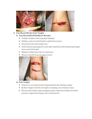 b. Luka Bunuh Diri dan Luka Tangkis
1) Luka Bunuh Diri (Self-Inflicted Wounds)
 Terdapat di bagian tubuh yang dapat dijangkau
 Multiple, sejajar atau berkelompok, superfisial atau minor
 Bentuk luka teratur dan hampir sama
 Lebih dominan pada bagian kiri untuk right-handed dan lebih dominan pada bagian
kanan untuk left-handed
 Mungkin terdapat bekas luka iris sebelumnya
 Biasanya memiliki riwayatgangguan mental
2) Luka Tangkis
 Terjadi saat seseorang berusaha mempertahankan diri terhadap serangan
 Korban mungkin mencoba menangkis, menangkap, atau melempar senjata
 Biasanya pada telapak tangan, punggung tangan, lengan bawah bagian lateral dan
posterior, tungkai bawah bagian anterior dan posterior
 