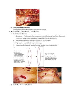 c. Kepentingan Medikolegal
Panjang luka tidak berhubungan dengan panjang senjata
2. Luka Tusuk / Vulnus Ictum / Stab Wound
a. Karakteristik Umum
 Kedalaman > Panjang luka. Saat mengukur panjang, kedua tepi luka harus dirapatkan
karena luka cenderung menganga dan memendek (gaping phenomenon)
 Bentuk luka tergantung dari faktor senjata dan faktor korban
 Tepi rata dan tajam (clean cut), berbatas tegas
 Mungkin terdapat memar di sekitar tempat tusukan karena gagang pisau
b. Luka Penetrasi dan Perforasi
 