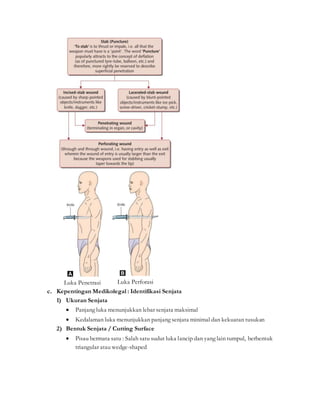 Luka Penetrasi Luka Perforasi
c. Kepentingan Medikolegal : Identifikasi Senjata
1) Ukuran Senjata
 Panjang luka menunjukkan lebar senjata maksimal
 Kedalaman luka menunjukkan panjang senjata minimal dan kekuatan tusukan
2) Bentuk Senjata / Cutting Surface
 Pisau bermata satu : Salah satu sudut luka lancip dan yang lain tumpul, berbentuk
triangular atau wedge-shaped
 