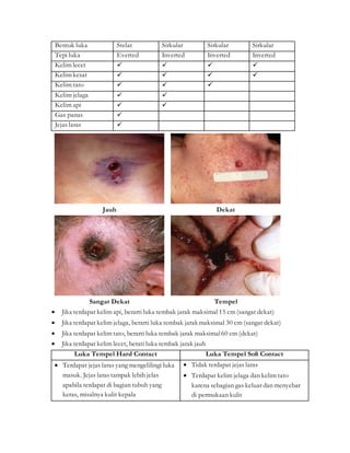 Bentuk luka Stelat Sirkular Sirkular Sirkular
Tepi luka Everted Inverted Inverted Inverted
Kelim lecet    
Kelim kesat    
Kelim tato   
Kelim jelaga  
Kelim api  
Gas panas 
Jejas laras 
Jauh Dekat
Sangat Dekat Tempel
 Jika terdapat kelim api, berarti luka tembak jarak maksimal 15 cm (sangat dekat)
 Jika terdapat kelim jelaga, berarti luka tembak jarak maksimal 30 cm (sangat dekat)
 Jika terdapat kelim tato, berarti luka tembak jarak maksimal60 cm (dekat)
 Jika terdapat kelim lecet, berati luka tembak jarak jauh
Luka Tempel Hard Contact Luka Tempel Soft Contact
 Terdapat jejas laras yang mengelilingi luka
masuk. Jejas laras tampak lebih jelas
apabila terdapat di bagian tubuh yang
keras, misalnya kulit kepala
 Tidak terdapat jejas laras
 Terdapat kelim jelaga dan kelim tato
karena sebagian gas keluar dan menyebar
di permukaan kulit
 