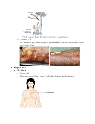  Tubuh hangus terbakar disertai kerusakan hebat sampai fraktur
6) Crocodile skin
Luka bakar atau spark lesion multiple di permukaan kulit yang luas karena percikan listrik
pada tegangan tinggi
6. Sengatan Petir
a. Efek Listrik
 Current mark
 Arborescent mark / filigree burns / Lichtenberg figures / fern-leaf pattern
 