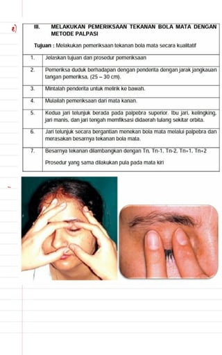 Catatan mata