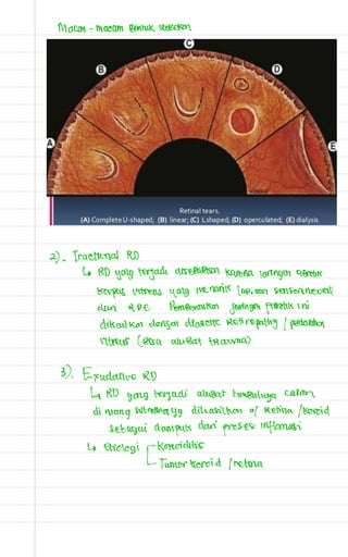 Catatan mata