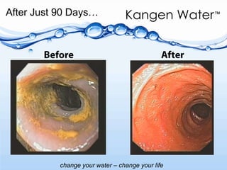 After Just 90 Days…BeforeAfter