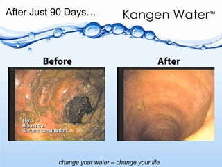 After Just 90 Days…BeforeAfter