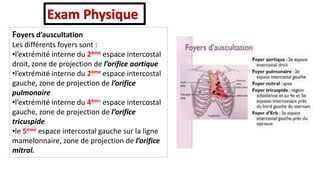 Foyers d’auscultation
Les différents foyers sont :
•l’extrémité interne du 2ème espace intercostal
droit, zone de projection de l’orifice aortique
•l’extrémité interne du 2ème espace intercostal
gauche, zone de projection de l’orifice
pulmonaire
•l’extrémité interne du 4ème espace intercostal
gauche, zone de projection de l’orifice
tricuspide
•le 5ème espace intercostal gauche sur la ligne
mamelonnaire, zone de projection de l’orifice
mitral.
Exam Physique
 