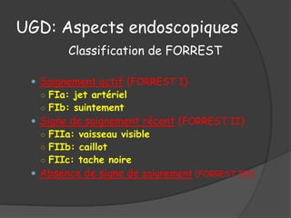 UGD: Aspects endoscopiques
        Classification de FORREST

  Saignement actif (FORREST I)
   ○ FIa: jet artériel
   ○ FIb: suintement
  Signe de saignement récent (FORREST II)
   ○ FIIa: vaisseau visible
   ○ FIIb: caillot
   ○ FIIc: tache noire
  Absence de signe de saignement (FORREST III)
 