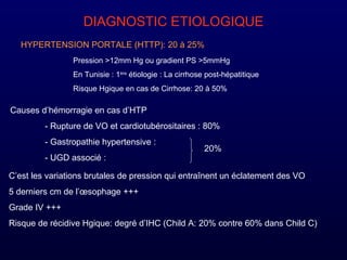 DIAGNOSTIC ETIOLOGIQUE
HYPERTENSION PORTALE (HTTP): 20 à 25%
Pression >12mm Hg ou gradient PS >5mmHg
En Tunisie : 1ère
étiologie : La cirrhose post-hépatitique
Risque Hgique en cas de Cirrhose: 20 à 50%
Causes d’hémorragie en cas d’HTP
- Rupture de VO et cardiotubérositaires : 80%
- Gastropathie hypertensive :
- UGD associé :
20%
C’est les variations brutales de pression qui entraînent un éclatement des VO
5 derniers cm de l’œsophage +++
Grade IV +++
Risque de récidive Hgique: degré d’IHC (Child A: 20% contre 60% dans Child C)
 