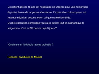 Un patient âgé de 18 ans est hospitalisé en urgence pour une hémorragie
digestive basse de moyenne abondance. L’exploration coloscopique est
revenue négative, aucune lésion colique n’a été identifiée.
Quelle exploration demandez-vous à ce patient tout en sachant que le
saignement s’est arrêté depuis déjà 3 jours ?
Quelle serait l’étiologie la plus probable ?
Réponse: diverticule de Meckel
 