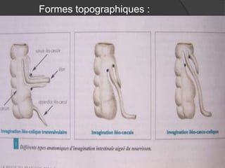 Formes topographiques :

 