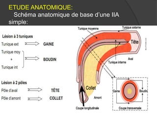 ETUDE ANATOMIQUE:
Schéma anatomique de base d’une IIA
simple:

 