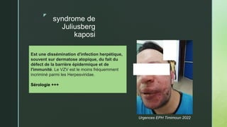 z
syndrome de
Juliusberg
kaposi
Est une dissémination d'infection herpétique,
souvent sur dermatose atopique, du fait du
défect de la barrière épidermique et de
l'immunité. Le VZV est le moins fréquemment
incriminé parmi les Herpesviridae.
Sérologie +++
Urgences EPH Timimoun 2022
 