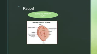 z
Rappel
ZONE DE RAMSAY
HUNT
 