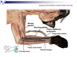 Flexor carpi radialis
Palmaris longus
Flexor carpi ulnaris
Biceps
brachii
Flexor digitorum
profundus
Brachioradialis
Pronator teres
 