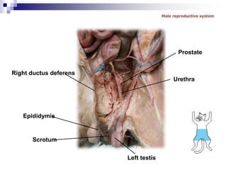 Right ductus deferens
Epididymis
Scrotum
Prostate
Urethra
Left testis
 