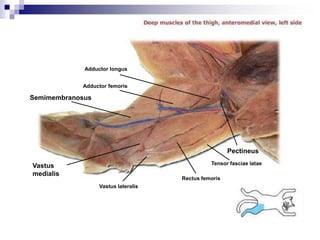 Adductor femoris
Tensor fasciae latae
Pectineus
Semimembranosus
Vastus
medialis
Vastus lateralis
Rectus femoris
Adductor longus
 