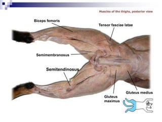 Semimembranosus
Gluteus medius
Semitendinosus
Gluteus
maximus
Biceps femoris
Tensor fasciae latae
 