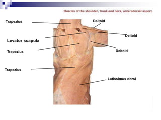 Deltoid
Trapezius
Levator scapula
Deltoid
Trapezius
Latissimus dorsi
DeltoidTrapezius
 