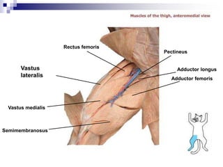 Pectineus
Rectus femoris
Vastus
lateralis
Semimembranosus
Adductor femoris
Adductor longus
Vastus medialis
 